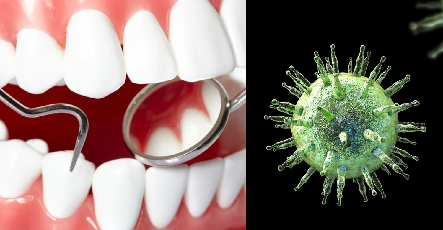 Epstein Barr Virus and Oral Health 2